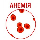 Анемія