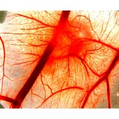 Геморагічний васкуліт